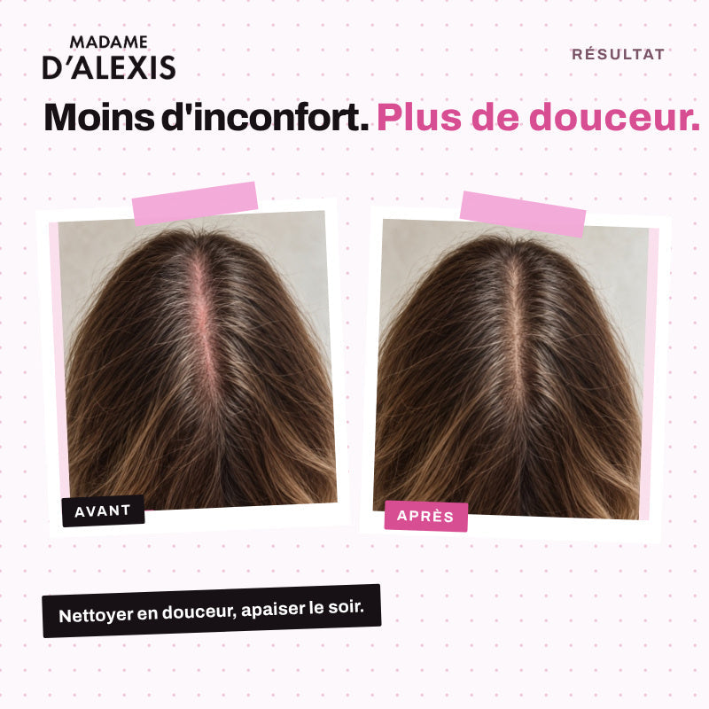 Le Pack Cuir Chevelu Sensible - Shampoing et Sérum Nuit aux hydrolats bio Madame d'Alexis