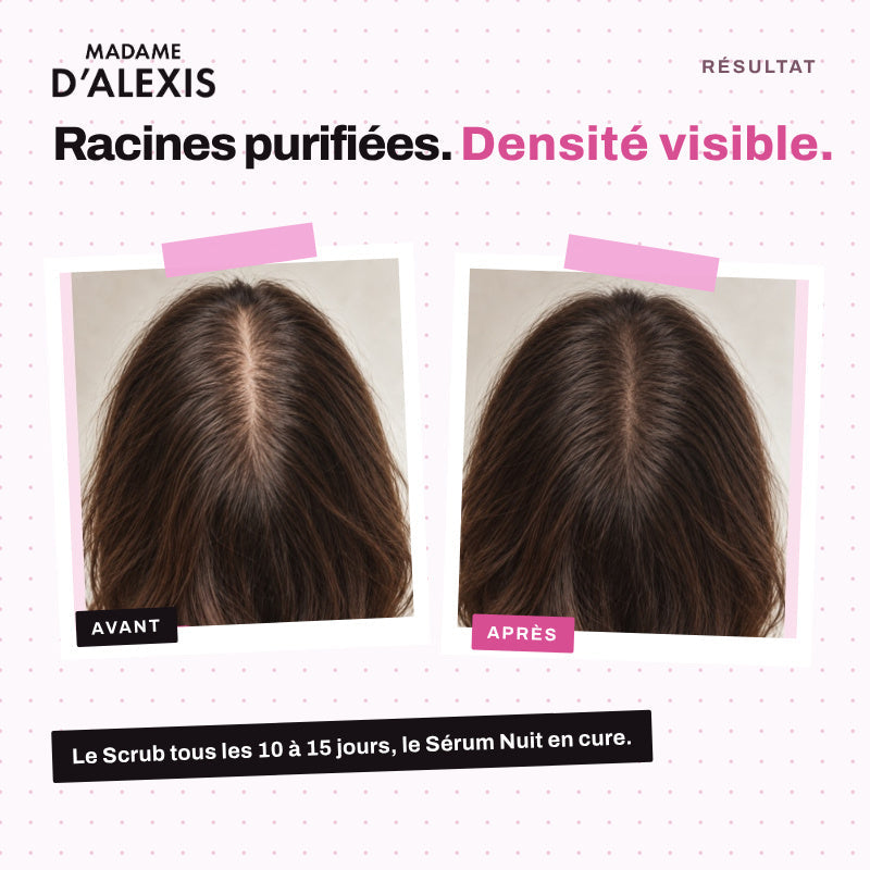 Le Rituel Croissance & Densité - Scrub et Sérum Nuit aux hydrolats bio Madame d'Alexis
