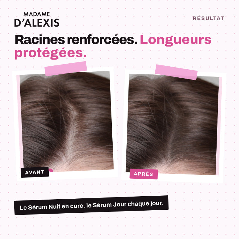 Anti-Hair Loss & Protection Routine: Madame d'Alexis Day & Night Serum