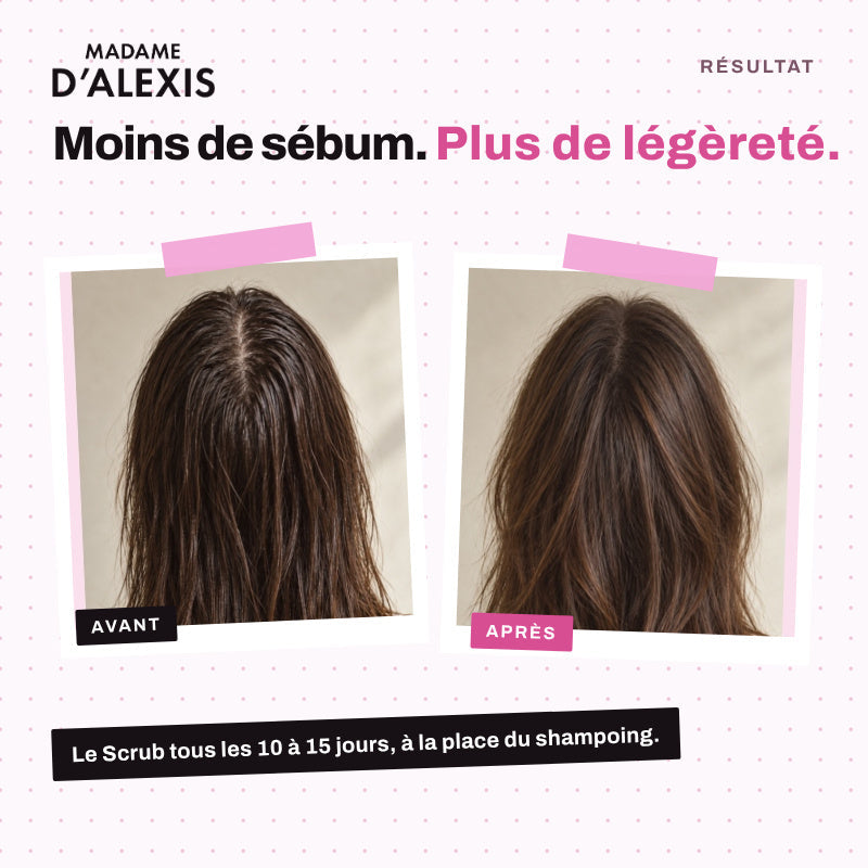 Routine Cheveux Gras : Scrub, Shampoing & Sérum Nuit aux hydrolats bio Madame d'Alexis